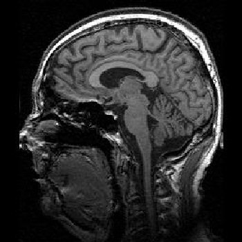 mri brain scan. MR-TIP - MRI Images: Brain MRI