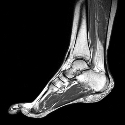 MRI Sliders - MRI - Anatomic Imaging of the Foot - MR-TIP.com