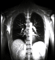 Mri Images Anatomic Imaging Of The Lungs Mr Tip Com
