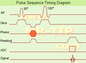 Spin Echo Timing Diagram