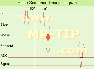 Ultrafast Gradient Echo Sequence Timing Diagram